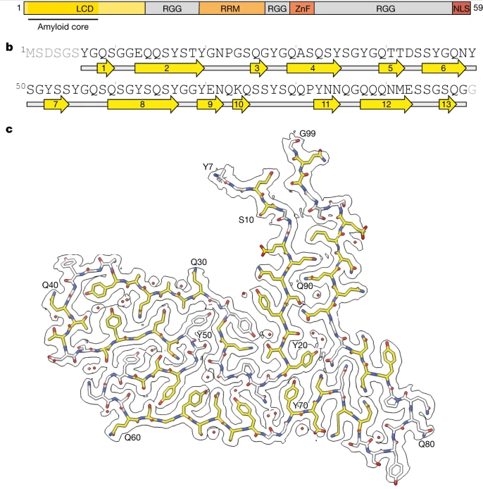 Nature：科學家識別出與人類額顳葉癡呆癥發(fā)生相關的新型蛋白質(zhì)