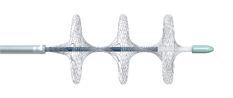 國內(nèi)首創(chuàng)！本市研發(fā)生產(chǎn)的1款Ⅲ類創(chuàng)新醫(yī)療器械獲批上市，為具有溶栓禁忌癥的患者提供了治療選擇